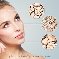 Le diverse tipologie di pelle: pelle secca